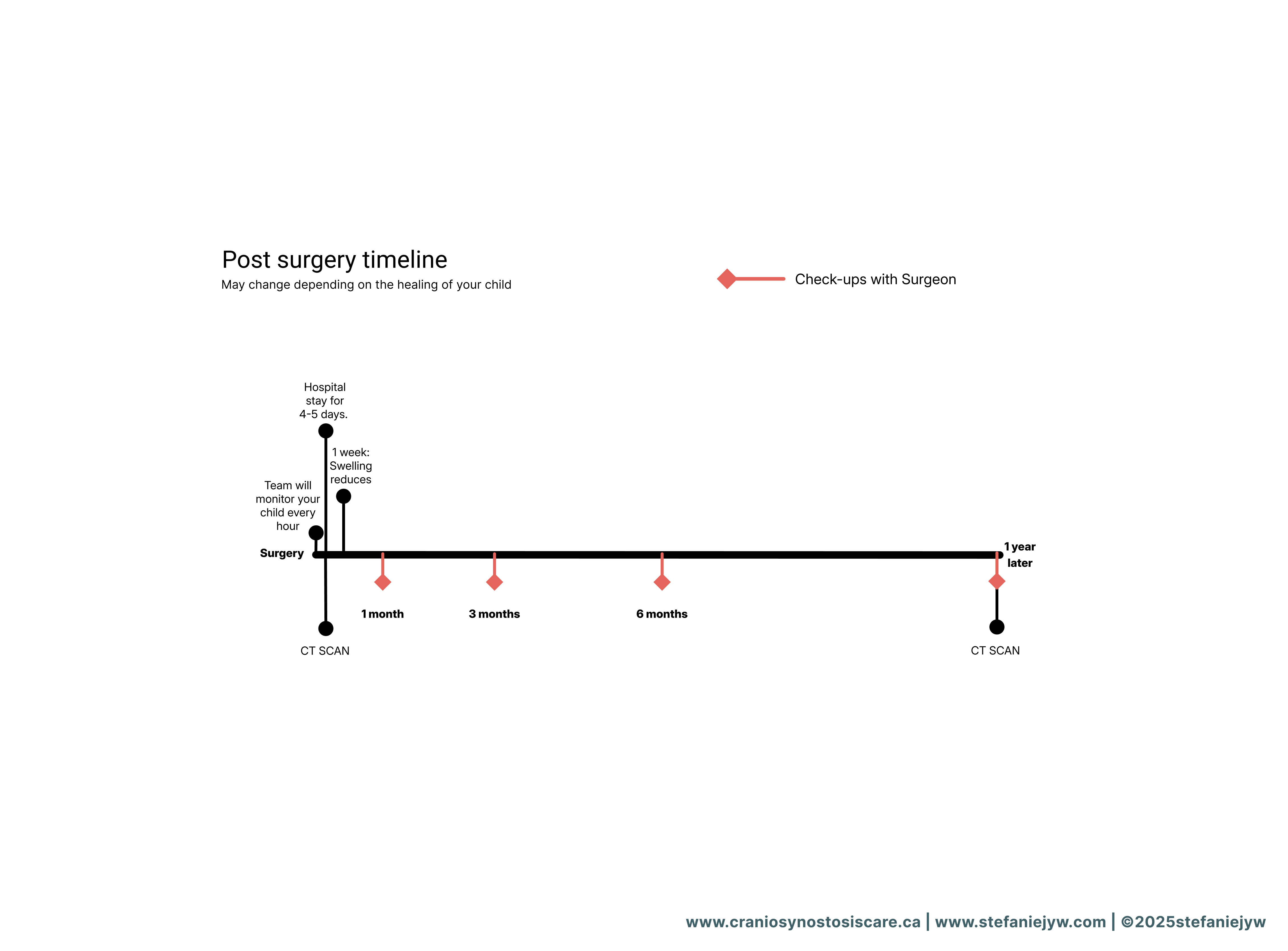 A post-surgery timeline for a child, titled Post surgery timeline, with a note that it May change depending on the healing of your child. The timeline starts with Surgery, followed by Hospital stay for 4/5 days. One week after surgery, Swelling reduces. The timeline shows Check-ups with Surgeon marked by orange diamond icons at 1 month, 3 months, and 6 months post-surgery. CT scans are scheduled at 1 month and 1 year post-surgery.